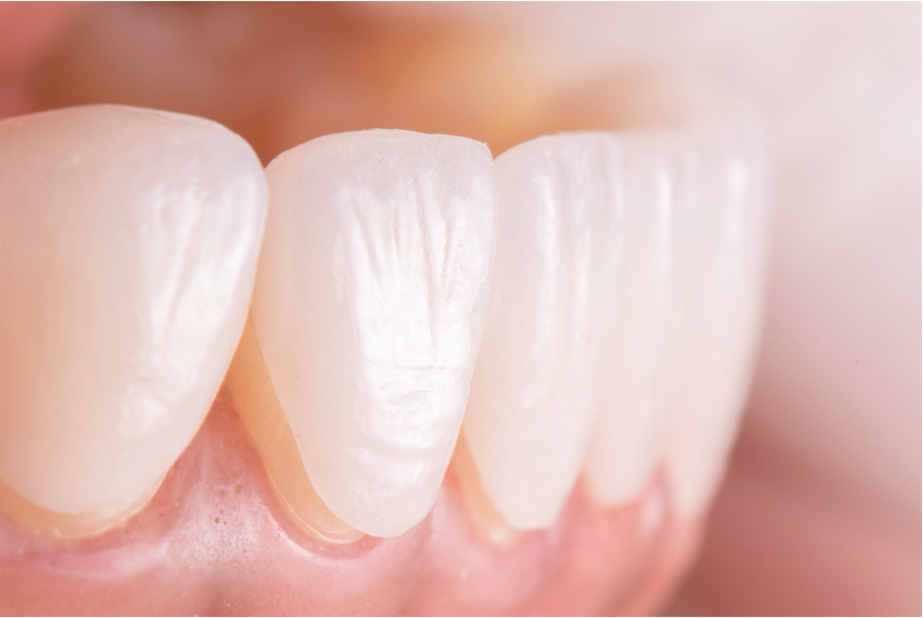 STL Dental Solution DENTAL LAB - CAD CAM Restorations | DentaCarts | Dental Cart