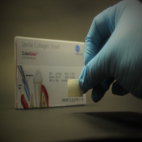 Cologide Resorbable GTR Membrane 10 mm X 15 mm