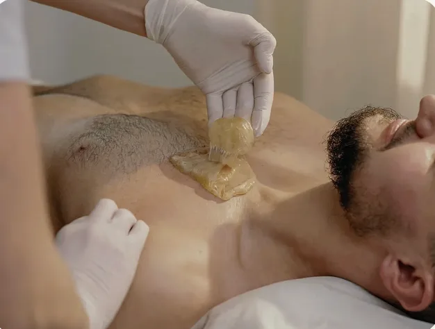 Depilacão Masculina