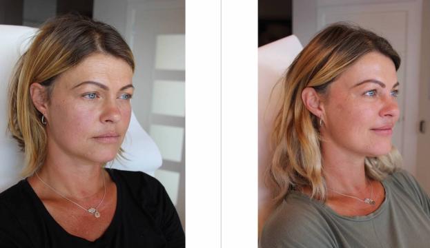 Fotovergelijking mw. Saskia Kamerbeek-4
