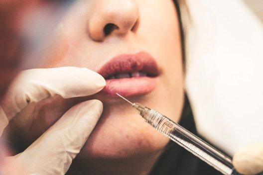 Ab welchem Alter Lippenfüller erlaubt