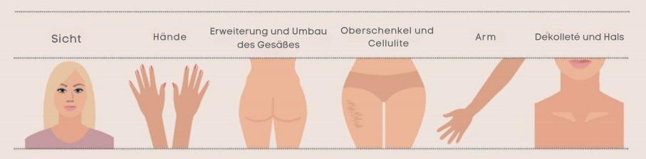 Gesäßvergrößerung
