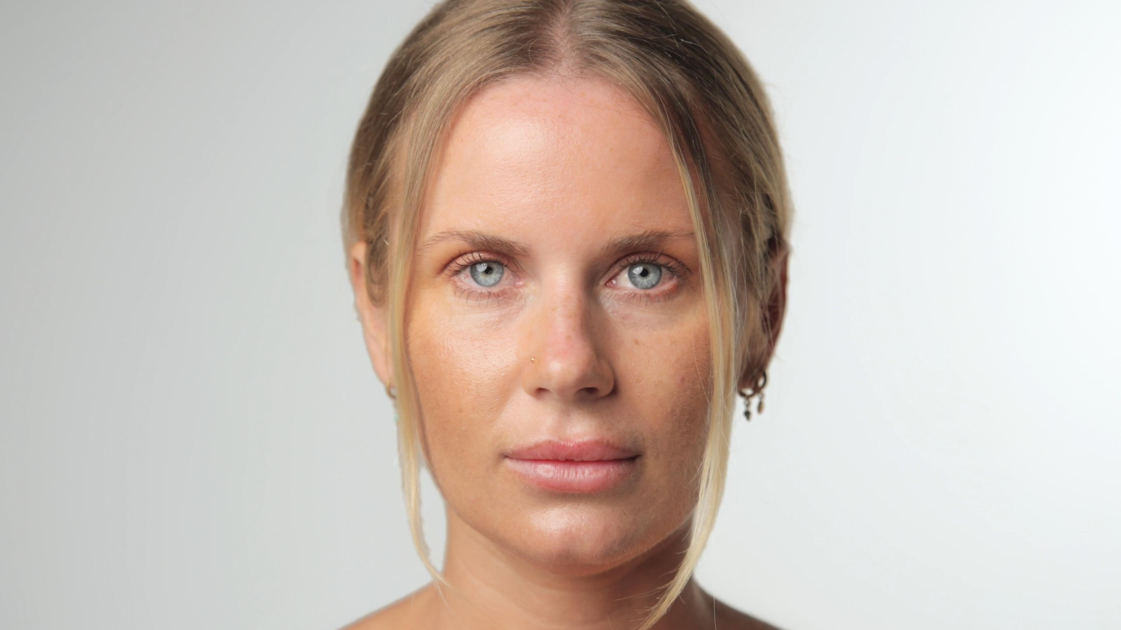 Nasenlöcher Botox