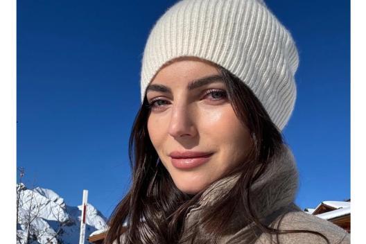 Kelly Piquet Botox und Lippenfüller: Hat sich Max Verstappens Freundin einer Schönheitsoperation unterzogen?