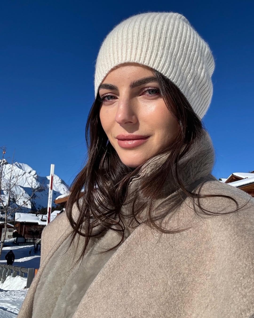 Kelly Piquet Botox und Lippenfüller: Hat sich Max Verstappens Freundin einer Schönheitsoperation unterzogen?