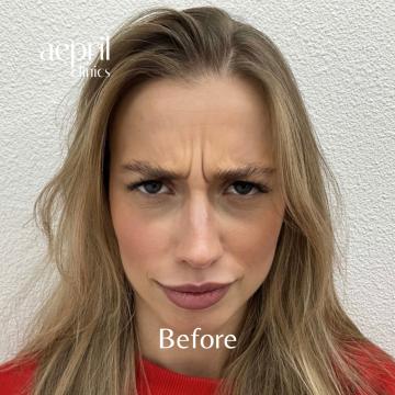 Before.zip - 1