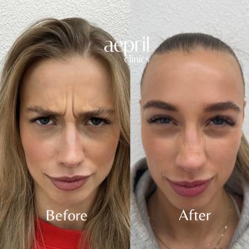 Before.zip - 2