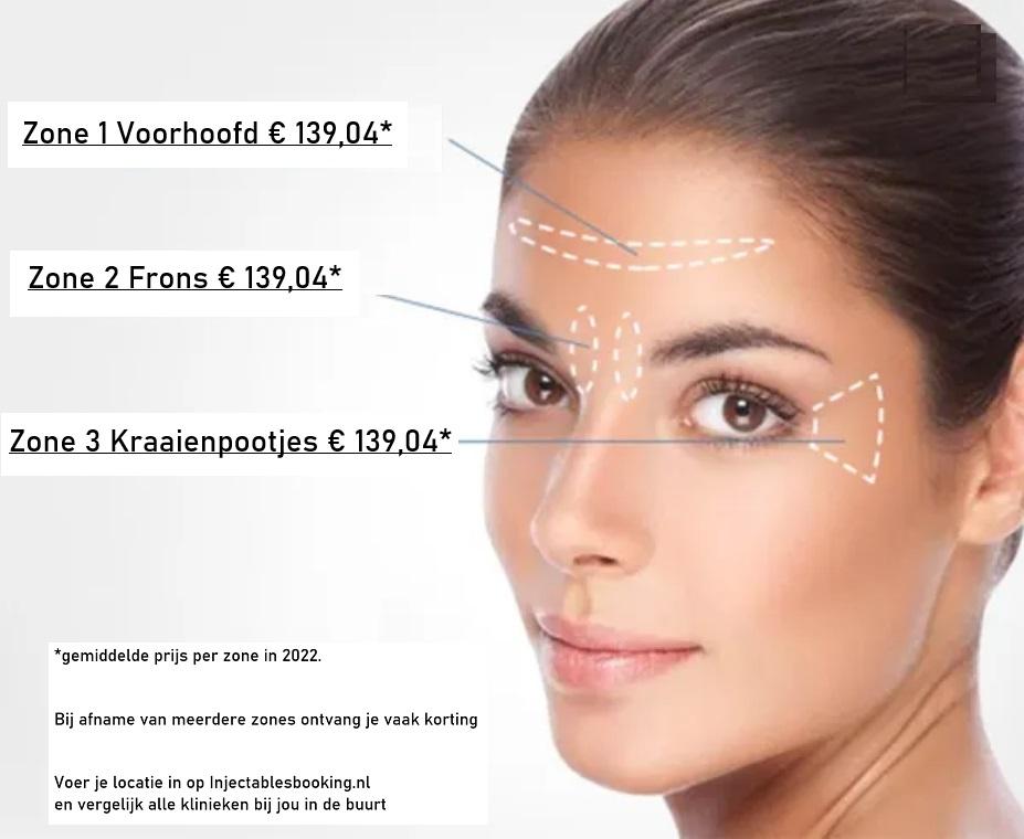 Botox-kosten-per-zone_2022