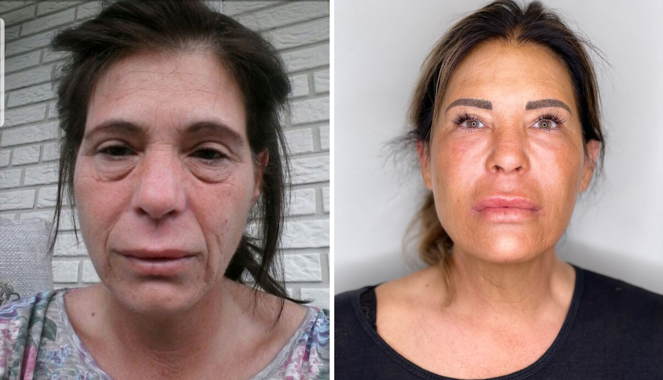 liquid_beauty_before-after