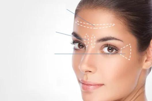 Hoe lang blijft botox zitten?