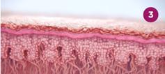 sculptra-werking