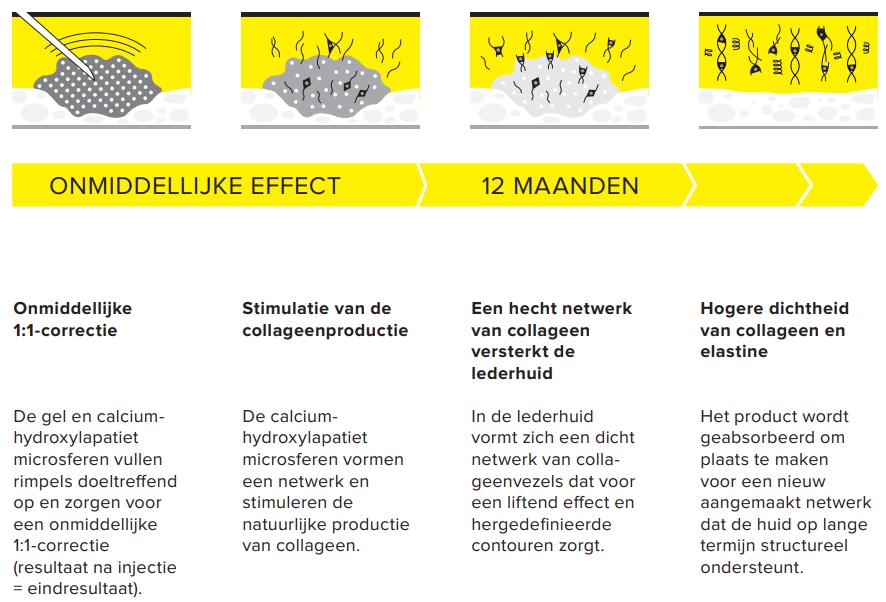 Radiesse-effect