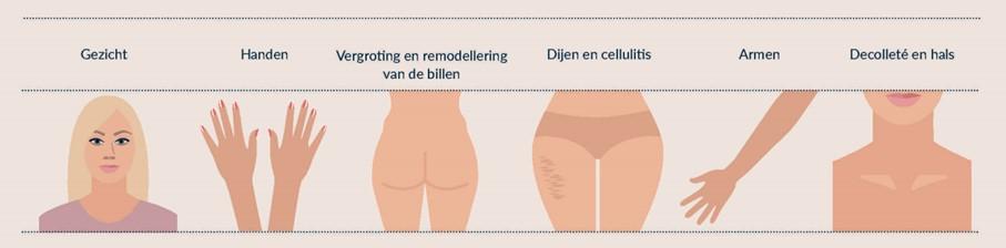 bilvergroting
