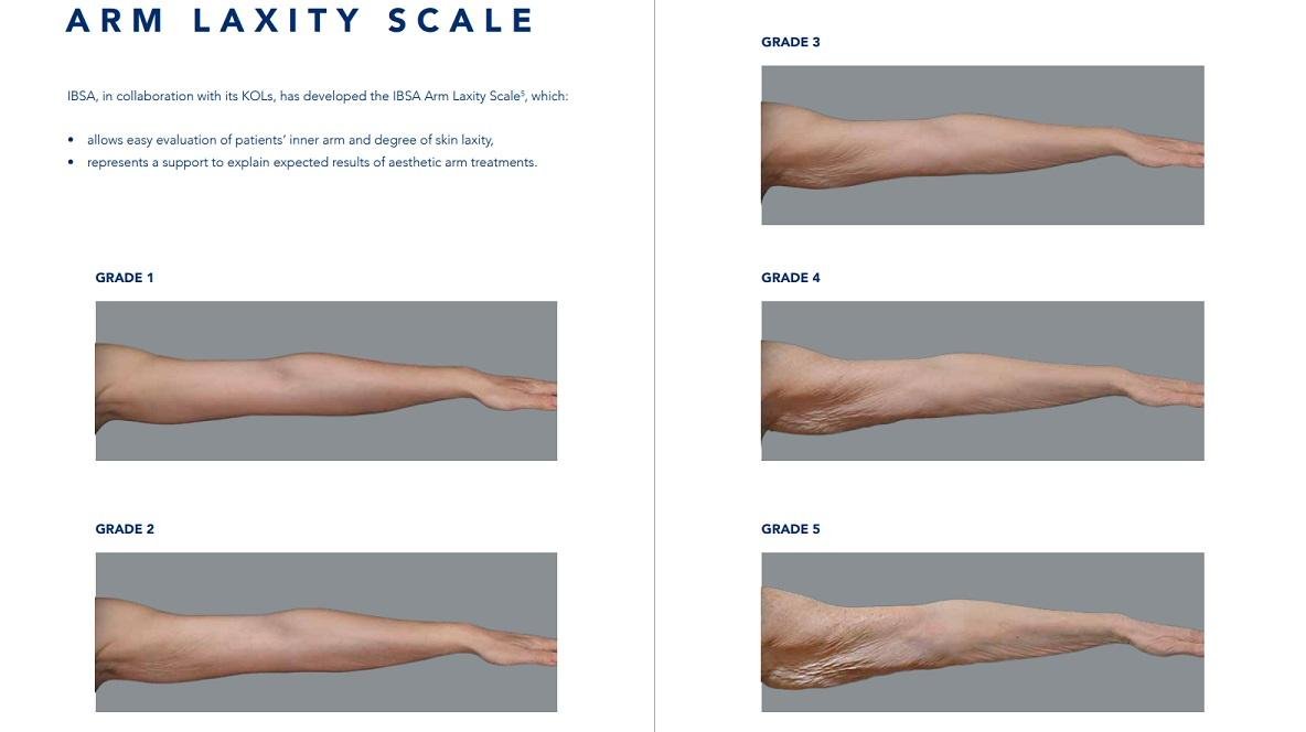 Profhilo-Body-Arm-Laxity-Scale