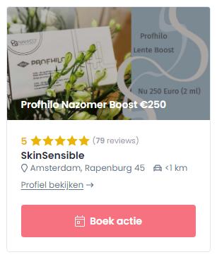 Promoot deals en acties