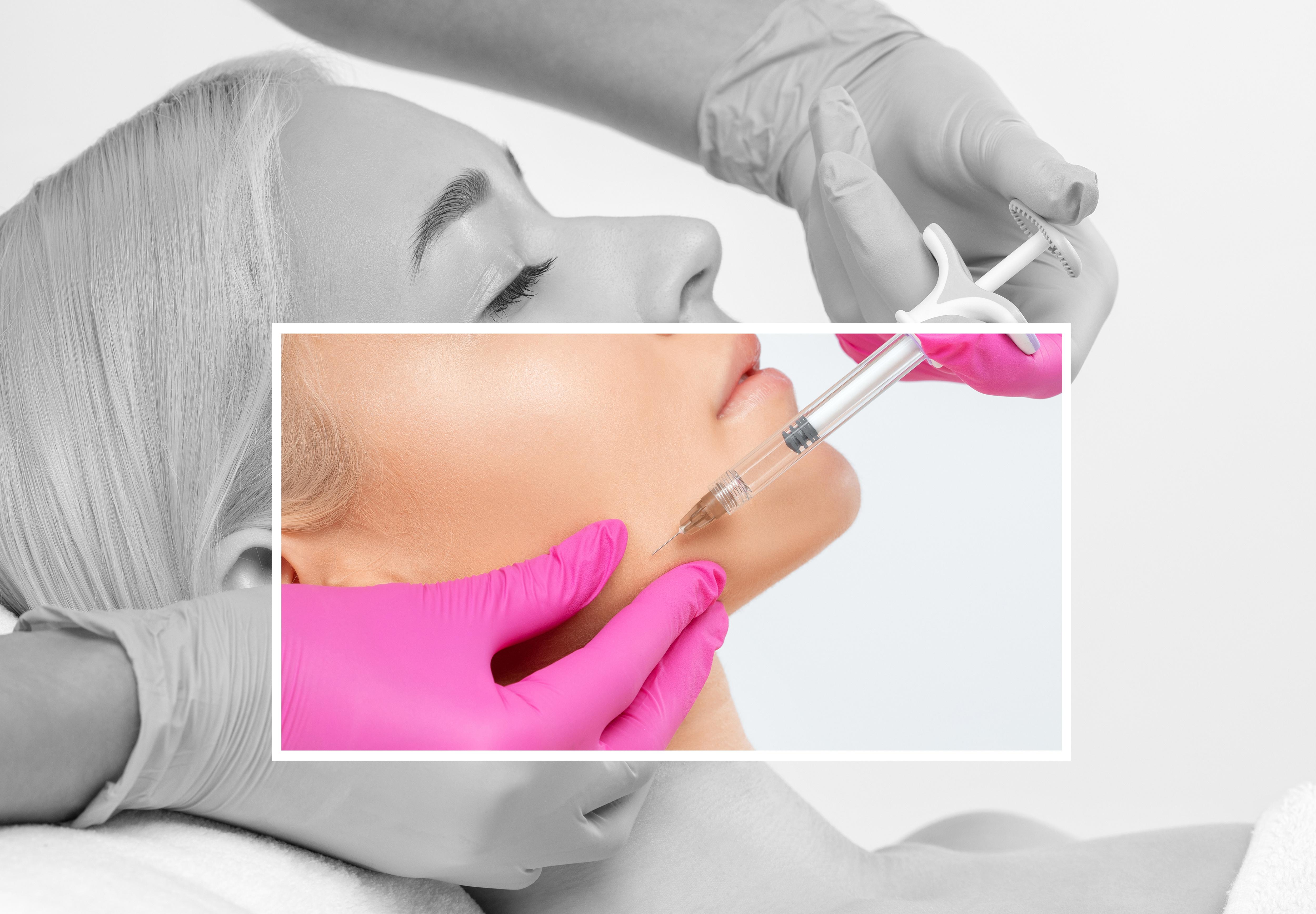 Kaaklijn verstrakken: Fillers, laser of draadjes