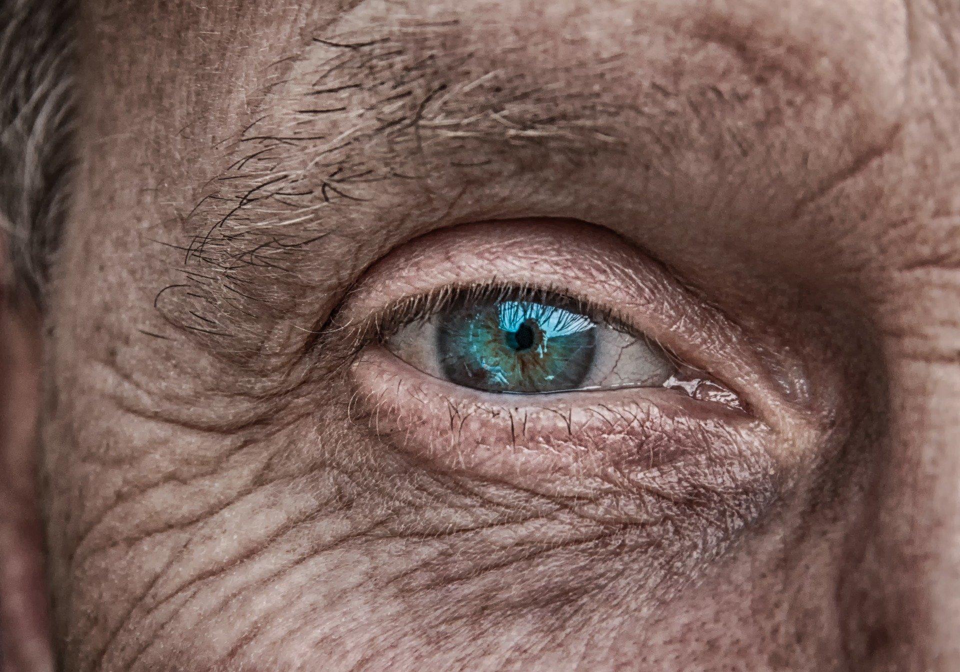 Skin aging (2)
