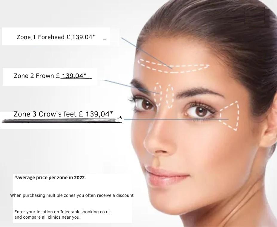 botox-cost-per-area_2022