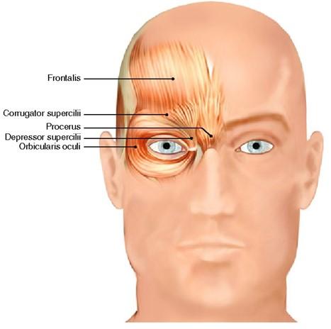 Spieren-botulinetoxine-rimpelbehandeling