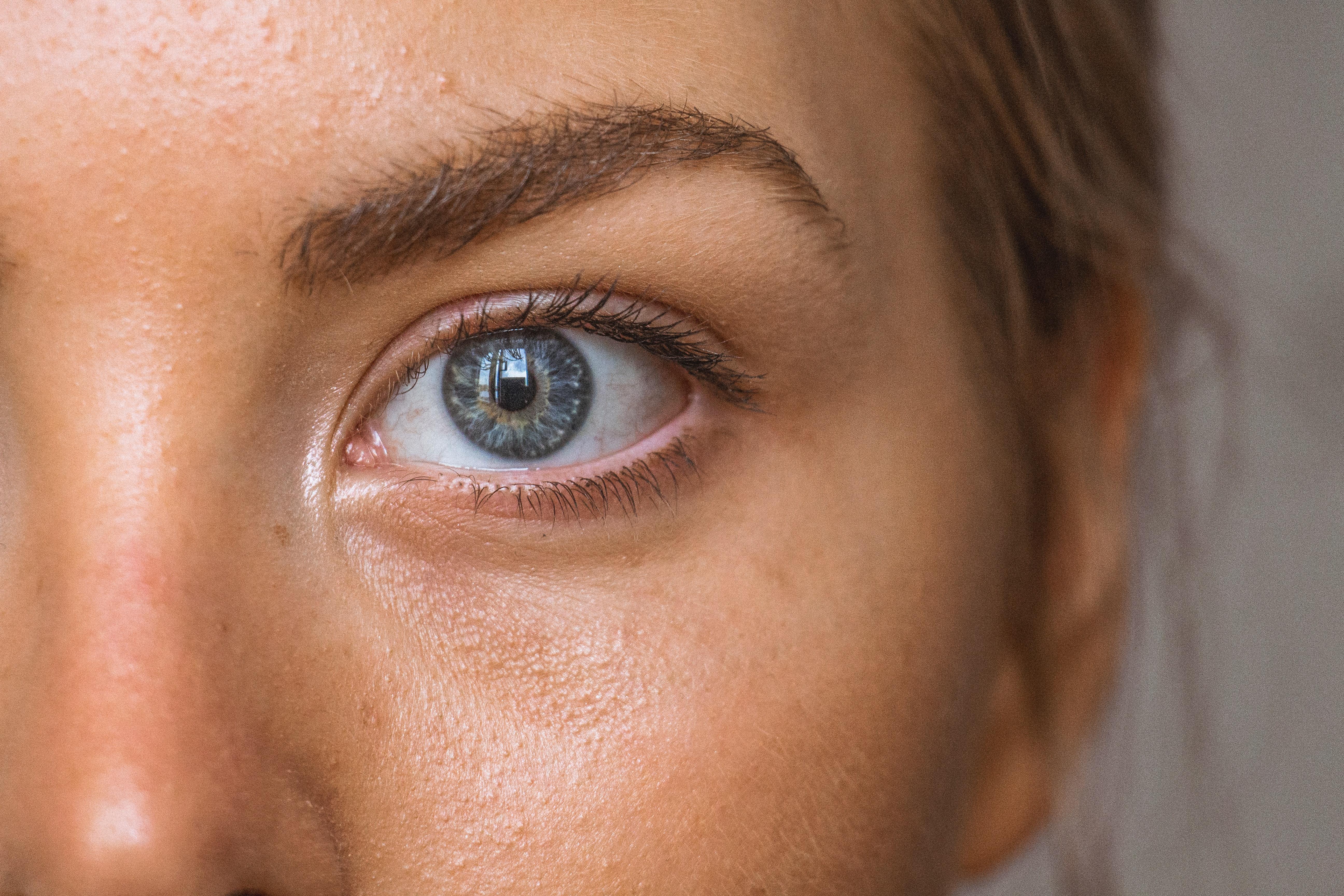 wrinkles-under-eyes