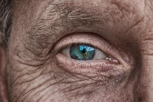 Treatment for skin aging