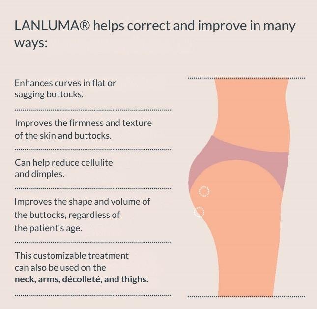 LANLUMA® 