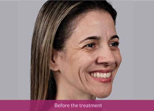 Before the treatment