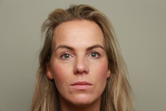 Voorfoto - lipfiller