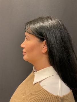 Voor behandeling Fenna (F) Zonneveld (10 dec 2024)