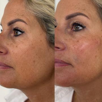 87A6BE1D-C450-4EC0-9653-8A2B9C1DE64C