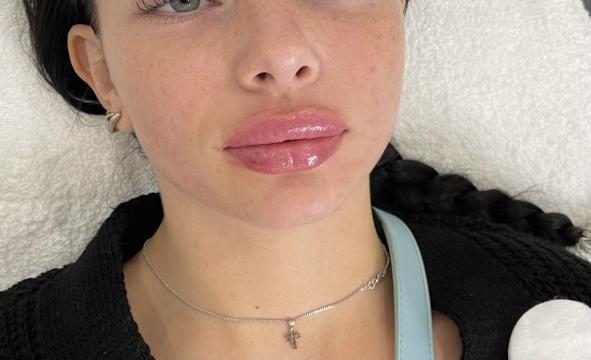 Lippen foto van SW Clinic (na)