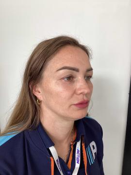 Fillers_jukbeen_voor