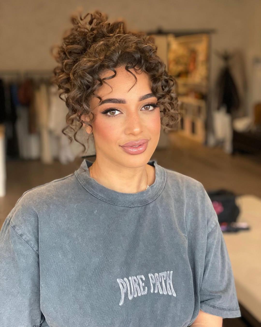 Heeft Channah Koerten botox?