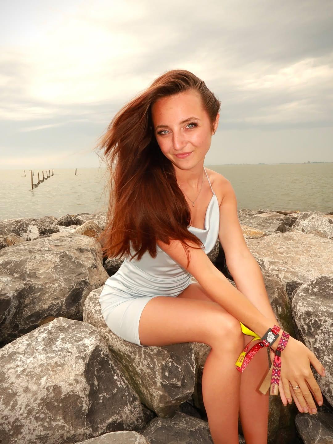 Heeft Sara Dol botox?