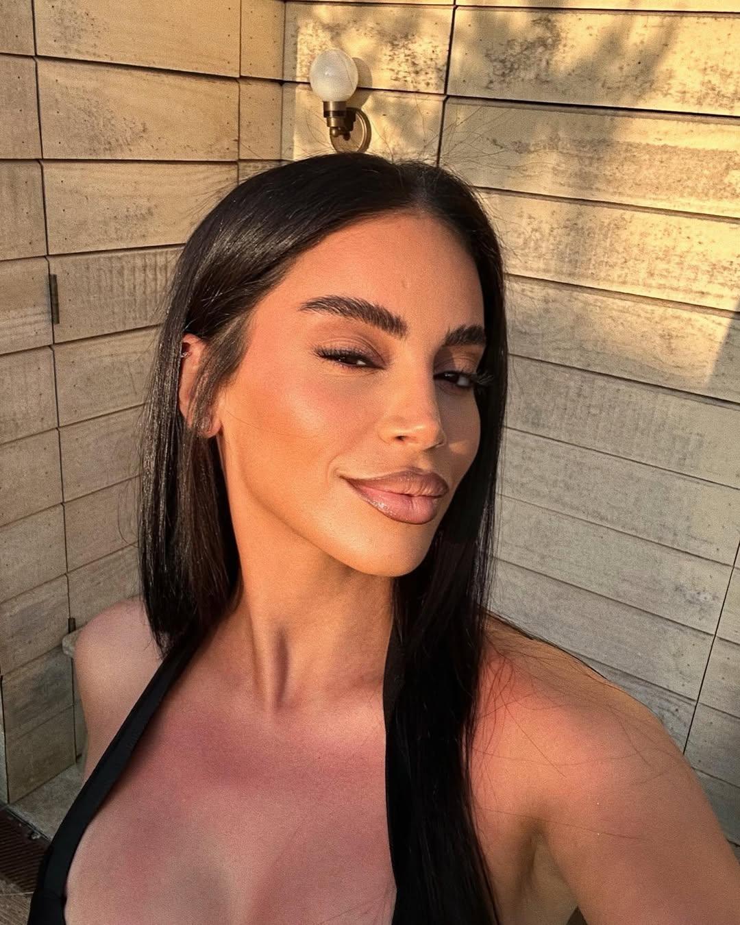 Heeft Selma Omari botox?