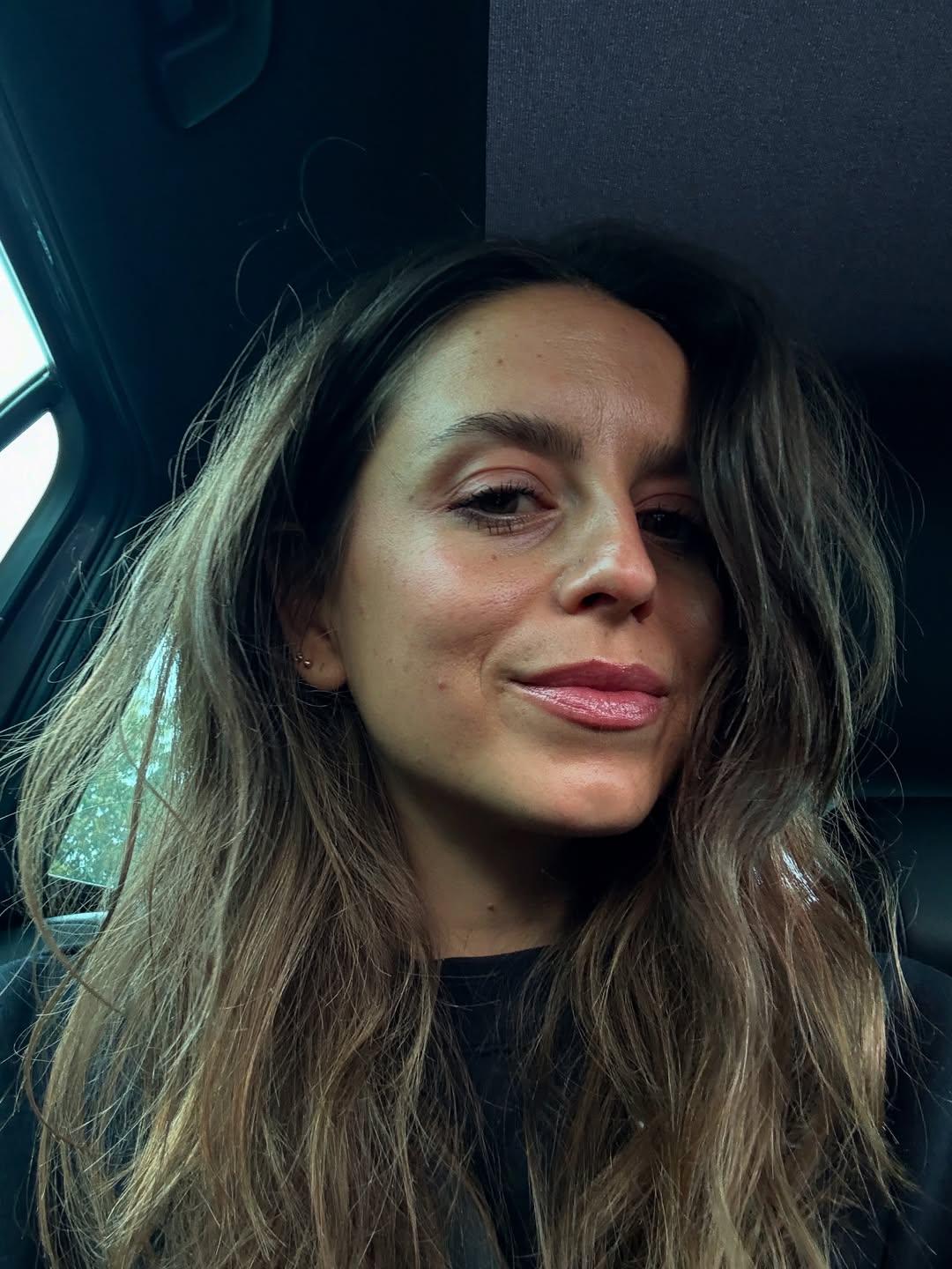 Heeft Lynn Van den Broeck Botox?