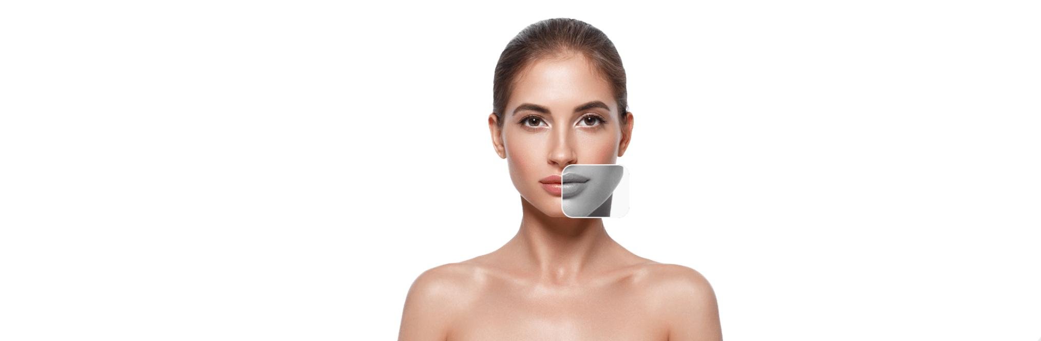 Fleur Cornelissen injectables