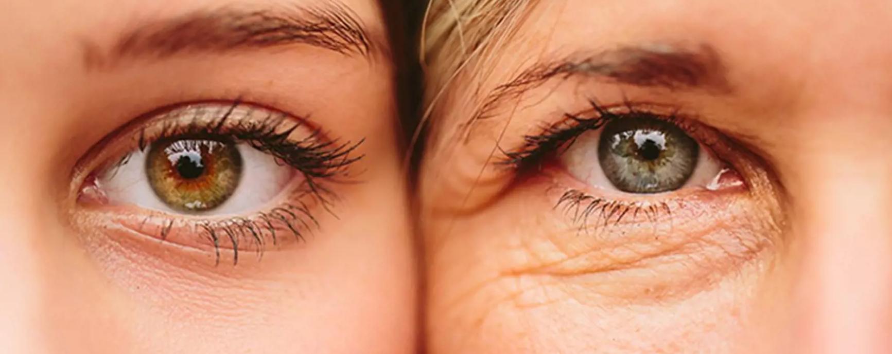 Injectables behandeling voor rimpels in Breda bij Huid Laser Centrum Breda