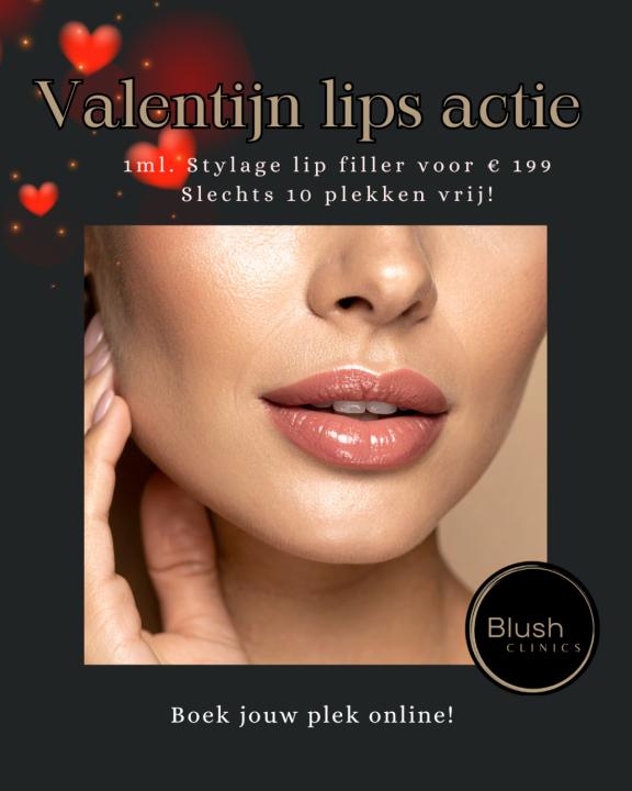 Valentijn lip deal: Stylage Actie!