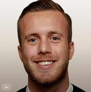 Tandvlees glimlach voor/na van The Body Clinic Amsterdam-Zuid (na)