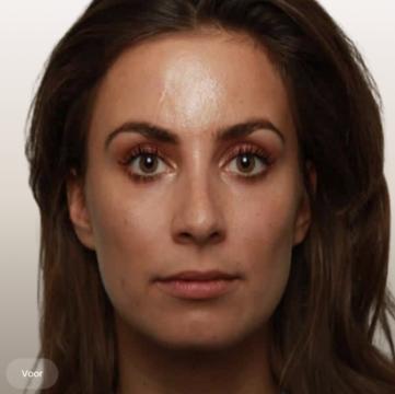 Lippen foto van The Body Clinic Den Bosch (voor)