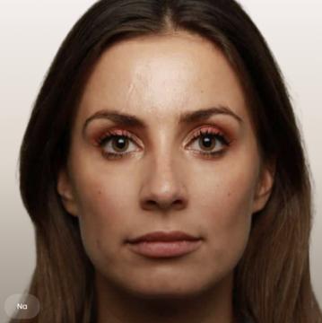 Lippen foto van The Body Clinic Den Bosch (na)