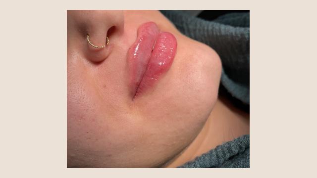 Lippen foto van Human Design GmbH (voor)