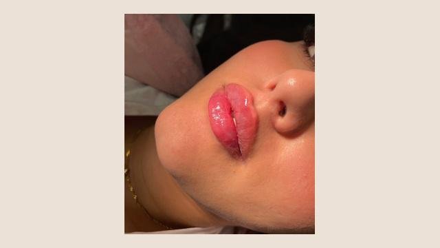 Lippen foto van Human Design GmbH (voor)