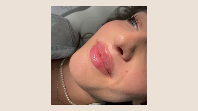 Lippen foto van Human Design GmbH (voor)