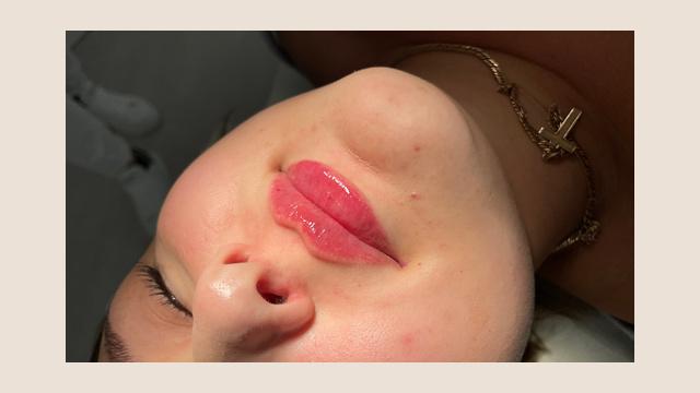 Lippen foto van Human Design GmbH (voor)