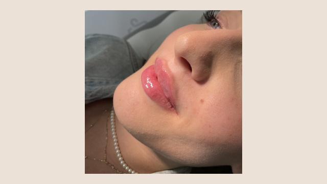 Lippen foto van Human Design GmbH (na)