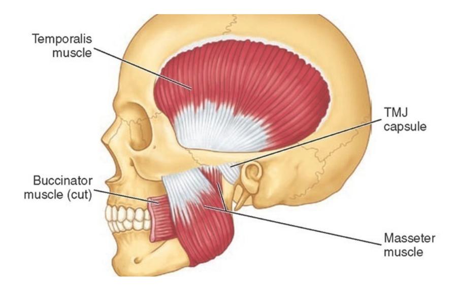 Traitement Botox du masséter