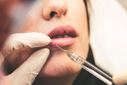 À partir de quel âge peut-on faire des injections des lèvres