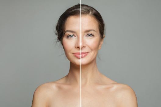 ¿Es malo el Botox para los músculos a largo plazo?